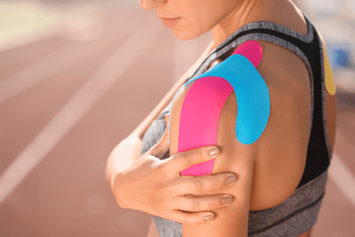 Woman with pink and blue kinesiology tape applied to upper arm and shoulder for muscle support.